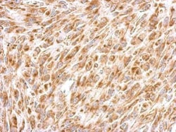 Invitrogen REA Polyclonal Antibody 100 &mu;L; Unconjugated:Antikroppar