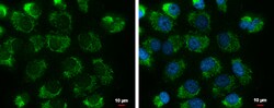 Invitrogen UQCRFS1 Polyclonal Antibody 100 μL; Unconjugated:Antibodies,