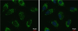 Invitrogen UQCRFS1 Polyclonal Antibody 100 μL; Unconjugated:Antibodies,