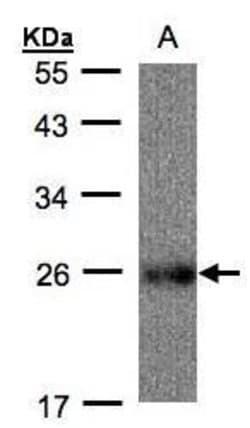 Invitrogen UQCRFS1 Polyclonal Antibody 100 μL; Unconjugated:Antibodies,