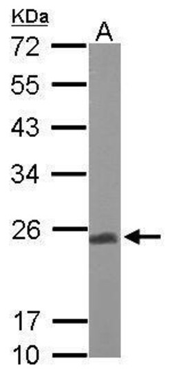 Invitrogen UQCRFS1 Polyclonal Antibody 100 μL; Unconjugated:Antibodies,