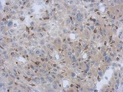 Invitrogen NDUFV1 Polyclonal Antibody 100 &mu;L | Buy Online | Invitrogen&trade; | Fisher Scientific