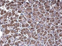 Invitrogen NDUFV1 Polyclonal Antibody 100 &mu;L | Buy Online | Invitrogen&trade; | Fisher Scientific