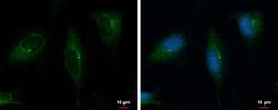 Invitrogen PRKD2 Polyclonal Antibody 100 μL; Unconjugated:Antibodies,