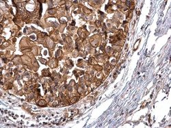 Invitrogen PRKD2 Polyclonal Antibody 100 μL; Unconjugated:Antibodies,