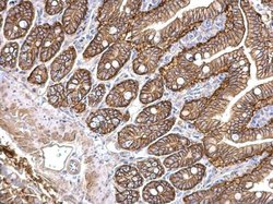 Invitrogen PRKD2 Polyclonal Antibody 100 μL; Unconjugated:Antibodies,