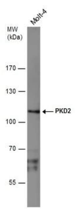 Invitrogen PRKD2 Polyclonal Antibody 100 μL; Unconjugated:Antibodies,