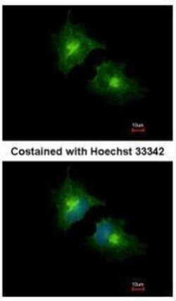 Invitrogen SCAMP3 Polyclonal Antibody 100 &mu;L; Unconjugated:Antibodies,
