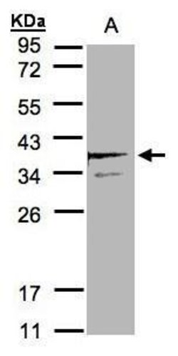 Invitrogen SCAMP3 Polyclonal Antibody 100 &mu;L; Unconjugated:Antibodies,