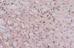 Invitrogen NUP62 Polyclonal Antibody 100 &mu;L; Unconjugated:Antibodies,