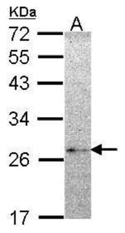Invitrogen NME5 Polyclonal Antibody 100 &mu;L; Unconjugated:Antibodies,
