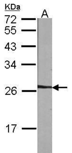 Invitrogen NME5 Polyclonal Antibody 100 &mu;L; Unconjugated:Antibodies,