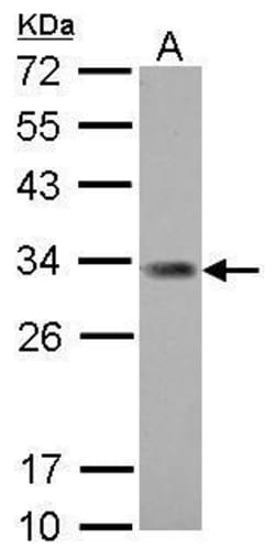 Invitrogen ING5 Polyclonal Antibody 100 &mu;L; Unconjugated:Antibodies,