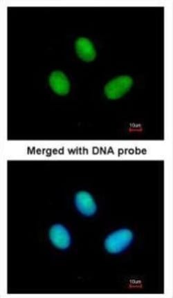 Invitrogen POLR2B Polyclonal Antibody 100 &mu;L; Unconjugated:Antibodies,