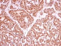 Invitrogen POLR2B Polyclonal Antibody 100 &mu;L; Unconjugated:Antibodies,