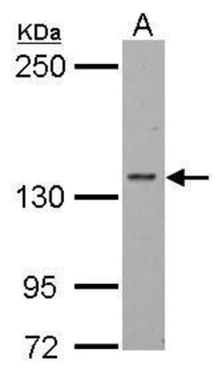 Invitrogen POLR2B Polyclonal Antibody 100 &mu;L; Unconjugated:Antibodies,