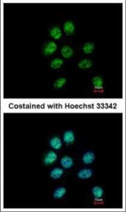 Invitrogen ZNF143 Polyclonal Antibody 100 &mu;L; Unconjugated:Antibodies,