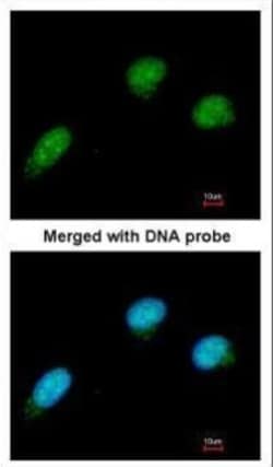 Invitrogen CtBP2 Polyclonal Antibody 100 μL; Unconjugated:Antibodies,
