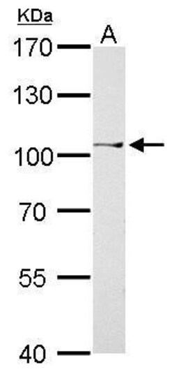 Invitrogen CtBP2 Polyclonal Antibody 100 μL; Unconjugated:Antibodies,
