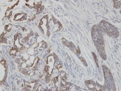 Invitrogen Cytokeratin 2e Polyclonal Antibody 100 &mu;L | Buy Online | Invitrogen&trade; | Fisher Scientific