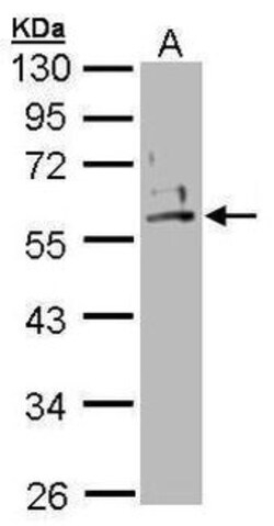 Invitrogen Cytokeratin 2e Polyclonal Antibody 100 &mu;L | Buy Online | Invitrogen&trade; | Fisher Scientific