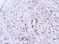 Invitrogen NEK4 Polyclonal Antibody 100 &mu;L; Unconjugated:Antibodies,