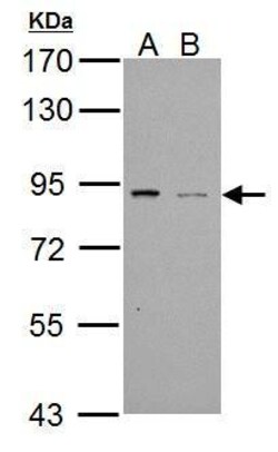 Invitrogen PDE4B Polyclonal Antibody 100 &mu;L; Unconjugated:Antibodies,