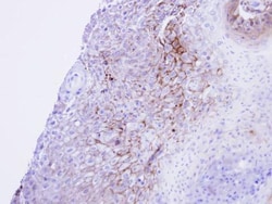 Invitrogen CaV1.1 Polyclonal Antibody 100 μL; Unconjugated:Antibodies,