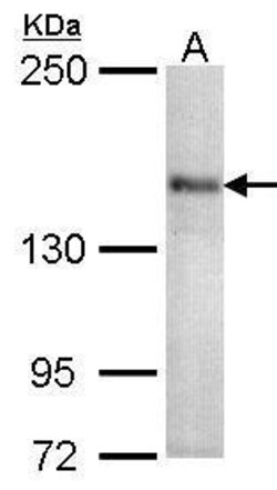 Invitrogen CaV1.1 Polyclonal Antibody 100 μL; Unconjugated:Antibodies,