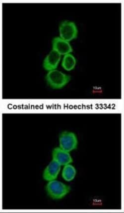 Invitrogen BHMT Polyclonal Antibody 100 &mu;L; Unconjugated:Antibodies,