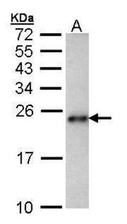 Invitrogen CRHSP-24 Polyclonal Antibody 100 &mu;L; Unconjugated:Antibodies,