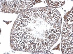 Invitrogen DMC1 Polyclonal Antibody 100 &mu;L; Unconjugated:Antibodies,