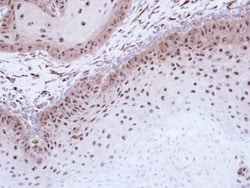 Invitrogen DMC1 Polyclonal Antibody 100 &mu;L; Unconjugated:Antibodies,