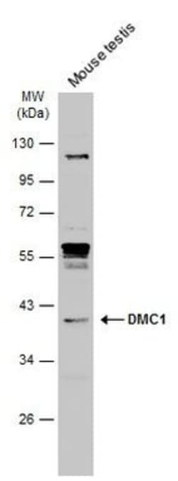 Invitrogen DMC1 Polyclonal Antibody 100 &mu;L; Unconjugated:Antibodies,