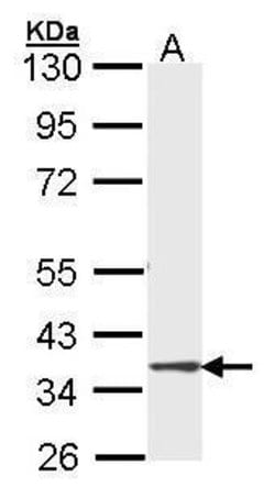 Invitrogen DMC1 Polyclonal Antibody 100 &mu;L; Unconjugated:Antibodies,