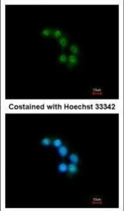 Invitrogen Unc18-2 Polyclonal Antibody 100 &mu;L; Unconjugated:Antibodies,