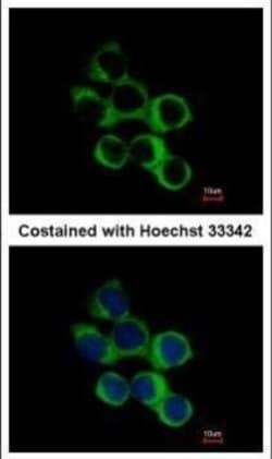 Invitrogen BBOX1 Polyclonal Antibody 100 &mu;L; Unconjugated:Antibodies,