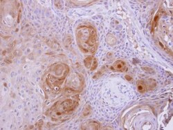 Invitrogen BBOX1 Polyclonal Antibody 100 &mu;L; Unconjugated:Antibodies,