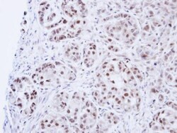 Invitrogen DNA Ligase III Polyclonal Antibody 100 &mu;L | Buy Online | Invitrogen&trade; | Fisher Scientific