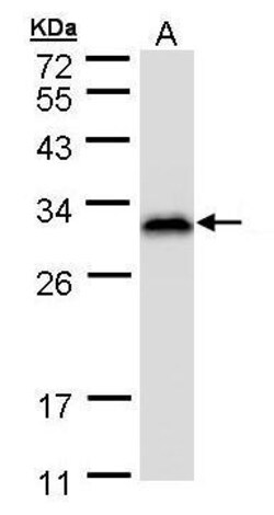 Invitrogen RANBP1 Polyclonal Antibody 100 &mu;L | Buy Online | Invitrogen&trade; | Fisher Scientific