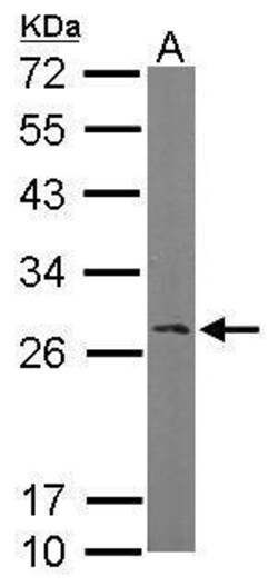 Invitrogen RANBP1 Polyclonal Antibody 100 &mu;L | Buy Online | Invitrogen&trade; | Fisher Scientific
