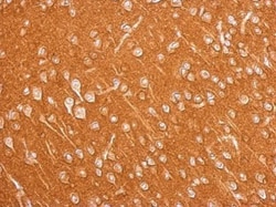 Invitrogen Amphiphysin Polyclonal Antibody 100 &mu;L; Unconjugated:Antibodies,