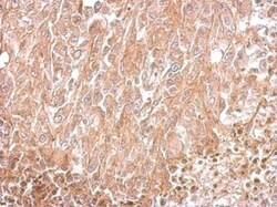 Invitrogen Amphiphysin Polyclonal Antibody 100 &mu;L; Unconjugated:Antibodies,