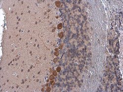 Invitrogen COPD Polyclonal Antibody 100 &mu;L; Unconjugated:Antibodies,