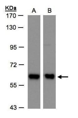 Invitrogen COPD Polyclonal Antibody 100 &mu;L; Unconjugated:Antibodies,