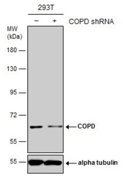 Invitrogen COPD Polyclonal Antibody 100 &mu;L; Unconjugated:Antibodies,