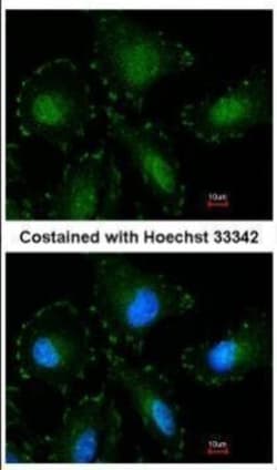 Invitrogen Calpain 5 Polyclonal Antibody 100 &mu;L; Unconjugated:Antibodies,