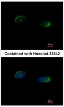 Invitrogen HOMER1 Polyclonal Antibody 100 &mu;L; Unconjugated:Antibodies,