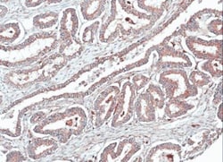 Invitrogen HOMER1 Polyclonal Antibody 100 &mu;L; Unconjugated:Antibodies,