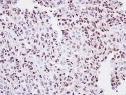Invitrogen ORC2 Polyclonal Antibody 100 &mu;L; Unconjugated:Antibodies,
